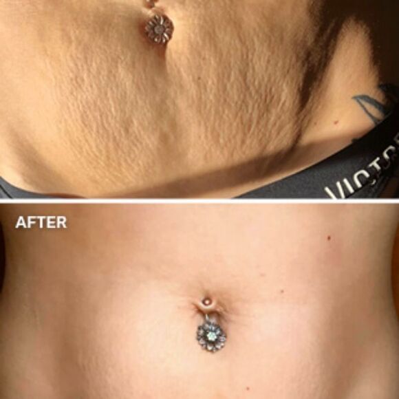 MAELLY'S Firming Belly Creme - Picture 4 of 8